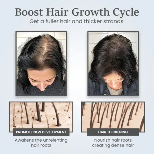 ThickTress Hair Growth Spray - Image 2