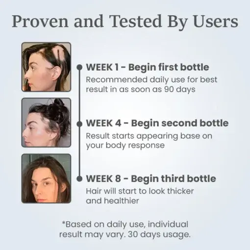 ThickTress Hair Growth Spray - Image 6