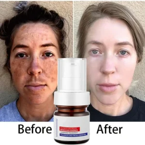 Alternative view of WHITENING ANDFRECKLE REMOVING ESSENCE