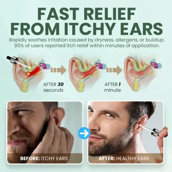 NESLEMY Ear Care Solution - Image 6