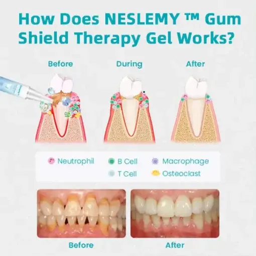 Gum Shield Therapy Gel - Image 6