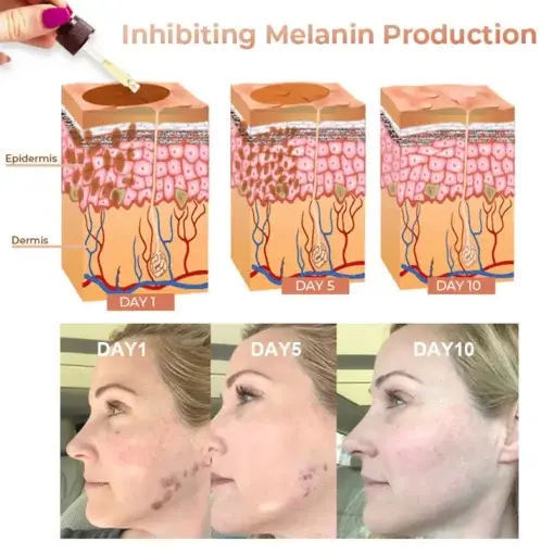 Melanin Correcting Facial Serum - Image 5