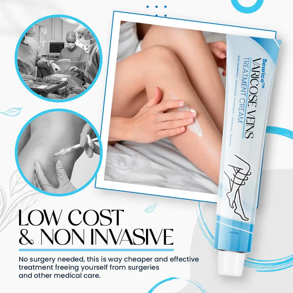 Varicose Veins Treatment Cream - Image 8
