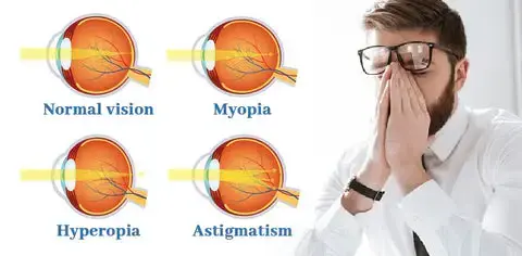 Vision recovery eye drops - Image 11