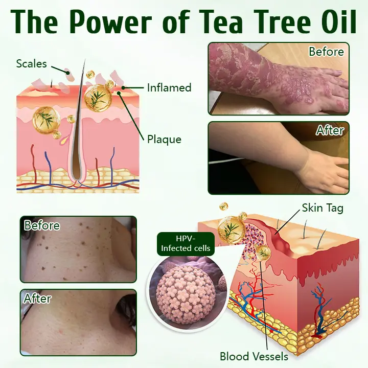 DermaPure Tea Tree Healing Cream - Image 2