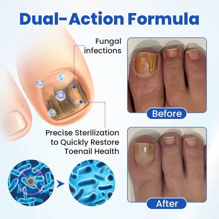 FungalPatch - Antibacterial Fungal Patch - Image 4