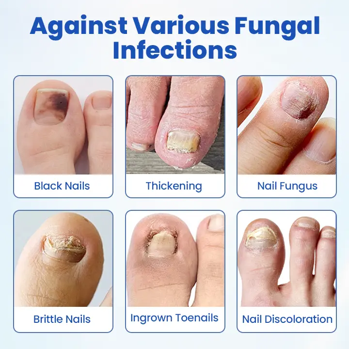 FungalPatch - Antibacterial Fungal Patch - Image 8