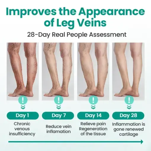 LegRenew Varicose Veins Patch - Image 3