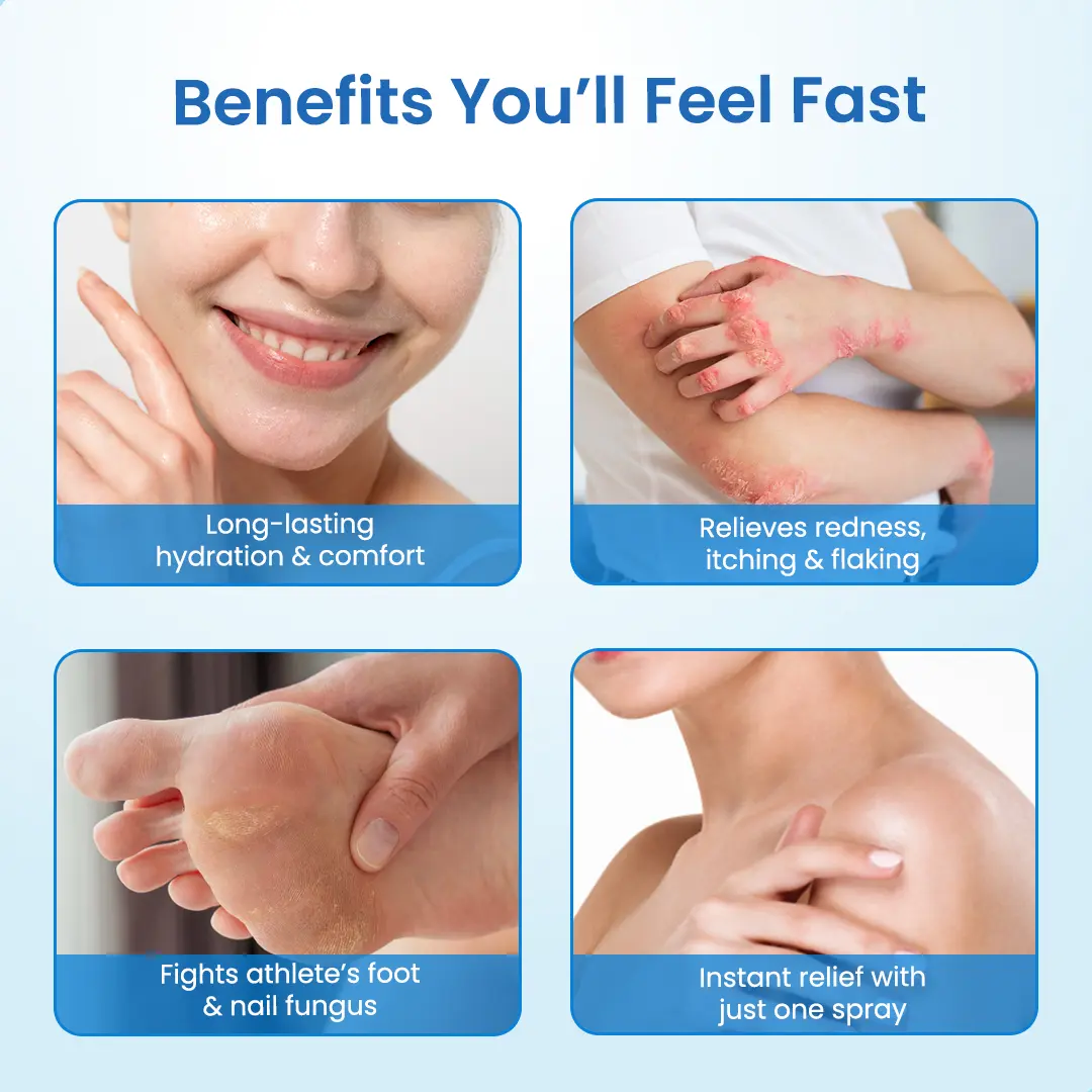 MagnesiumHerb Psoriasis Relief Cream - Image 7