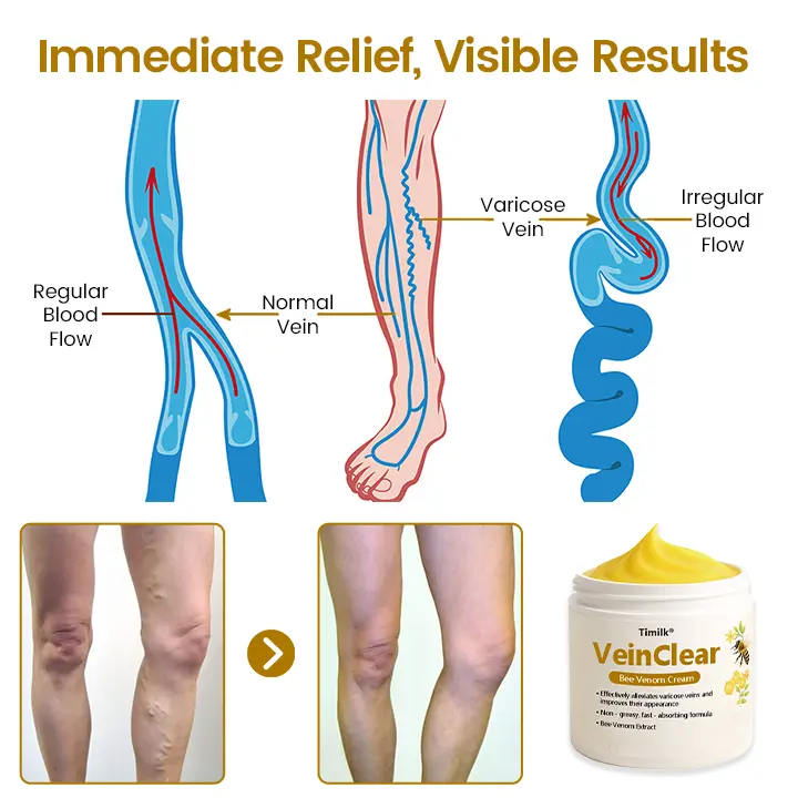 VeinClear Bee Venom Cream - Image 3