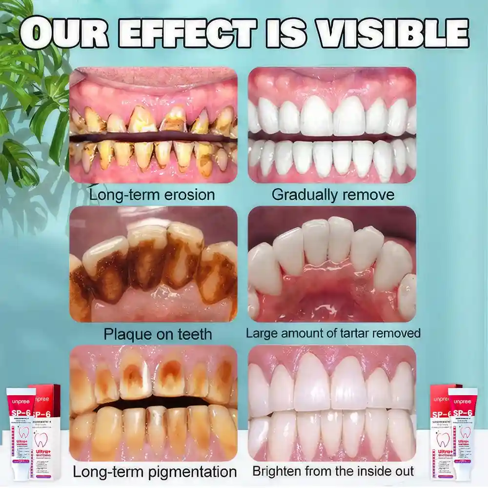 SP-6 Ultra+ Probiotic Whitening Toothpaste - Image 6