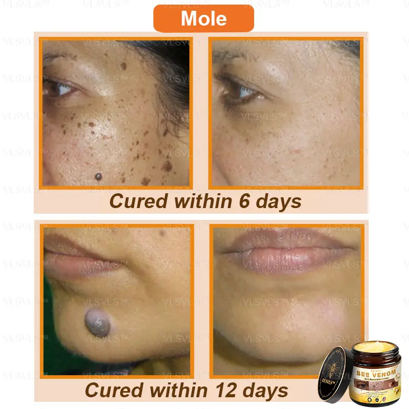Bee Venom Skin Restoration Cream - Image 4