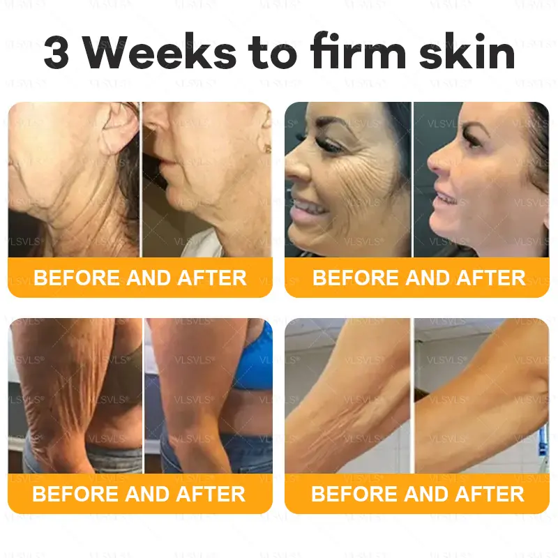 Bee Venom Skin Restoration Cream - Image 4