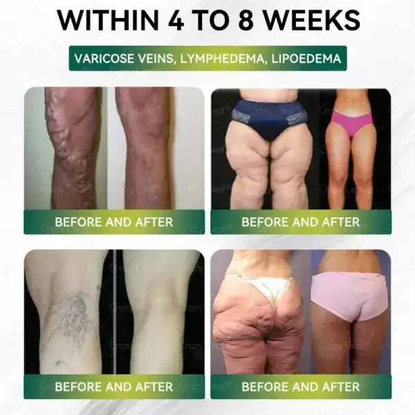 Weight Loss Oral Solution