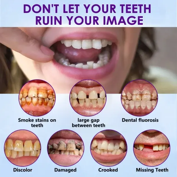 Advanced Customized Full Denture Set - Image 11