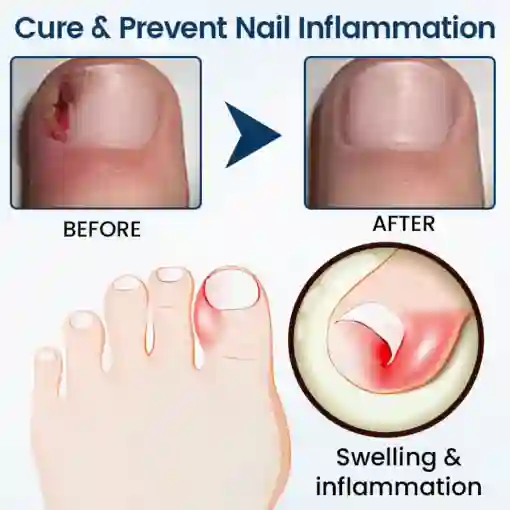 OnyxiGuard Fungal Repair Herbal Spray - Image 2