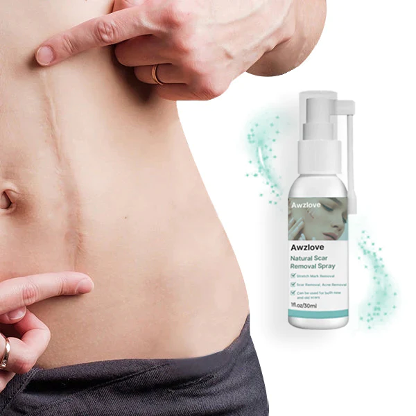 Natural Scar Removal Spray - Image 2
