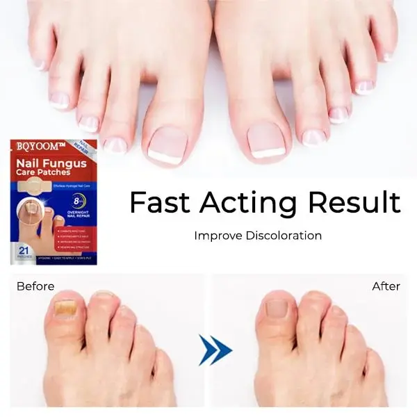 Nail Fungus Care Patches - Image 5