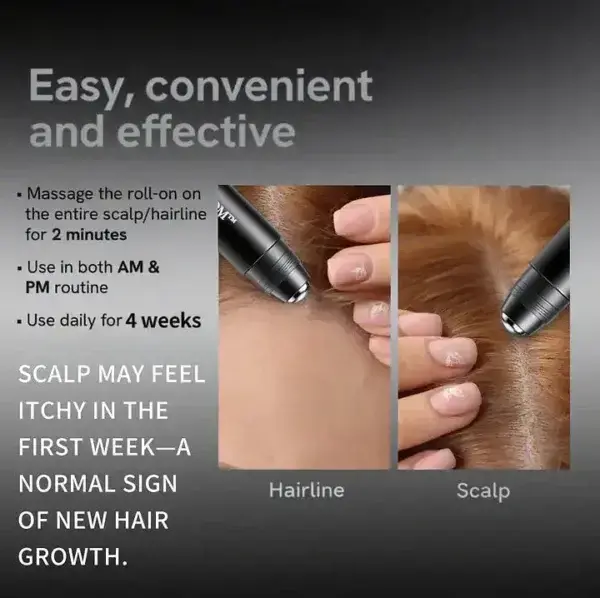 Professional Anti-Hair Loss Roll-On - Image 2
