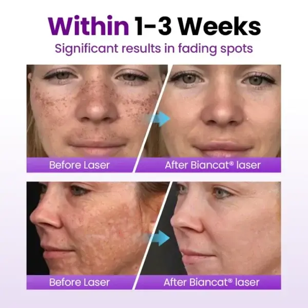 SpotErase Probiotic Shield Serum - Image 3
