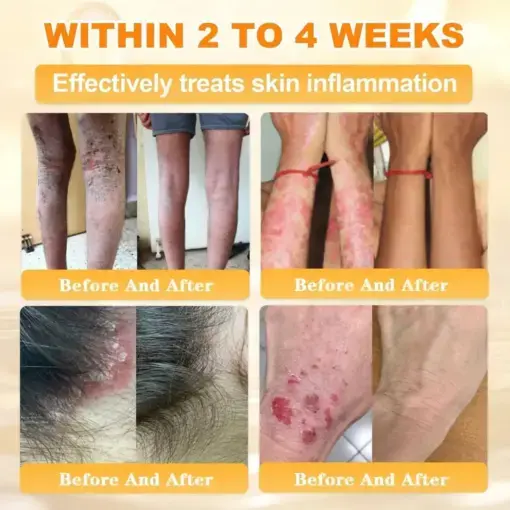 Bee Venom Skin Restoration Cream - Image 5