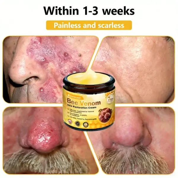 Bee Venom Skin Restoration Cream - Image 6