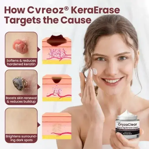 OryzaClear Black Rice Botanical Keratin-Softening Cream - Image 2