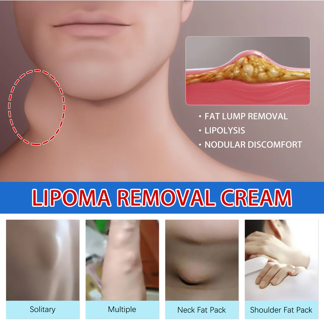 Bee Venom Lipoma Removal Cream - Image 5