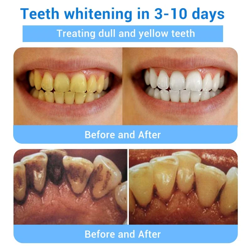 Teeth Restoration Mineral Powder - Image 25