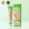 Knot-X Lipoma Dissolve Cream