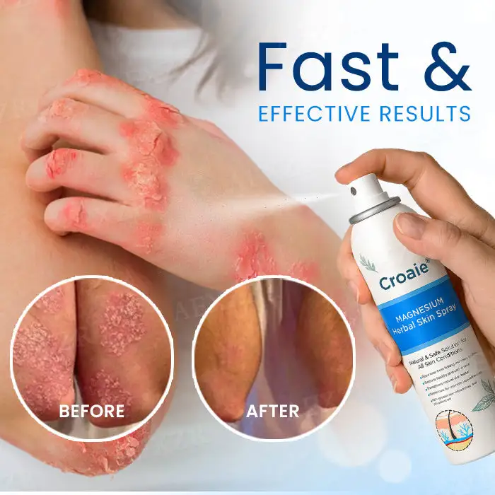 Magnesium Herbal Skin Spray - Image 3
