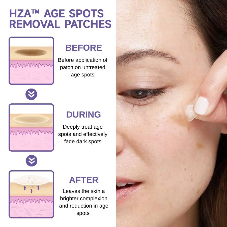 Age Spots Removal Patches - Image 2