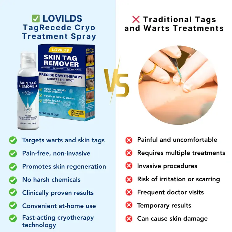 Cryo Treatment Spray Effortlessly remove skin tags and warts-no pain - Image 8