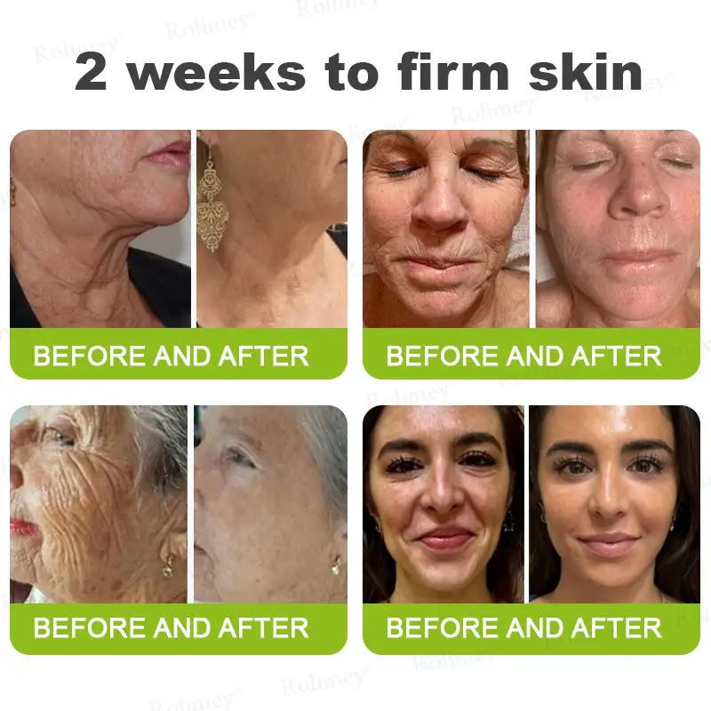 Botox & Vita-A Retinol Shot Wrinkle-Lift Tightening cream - Image 7