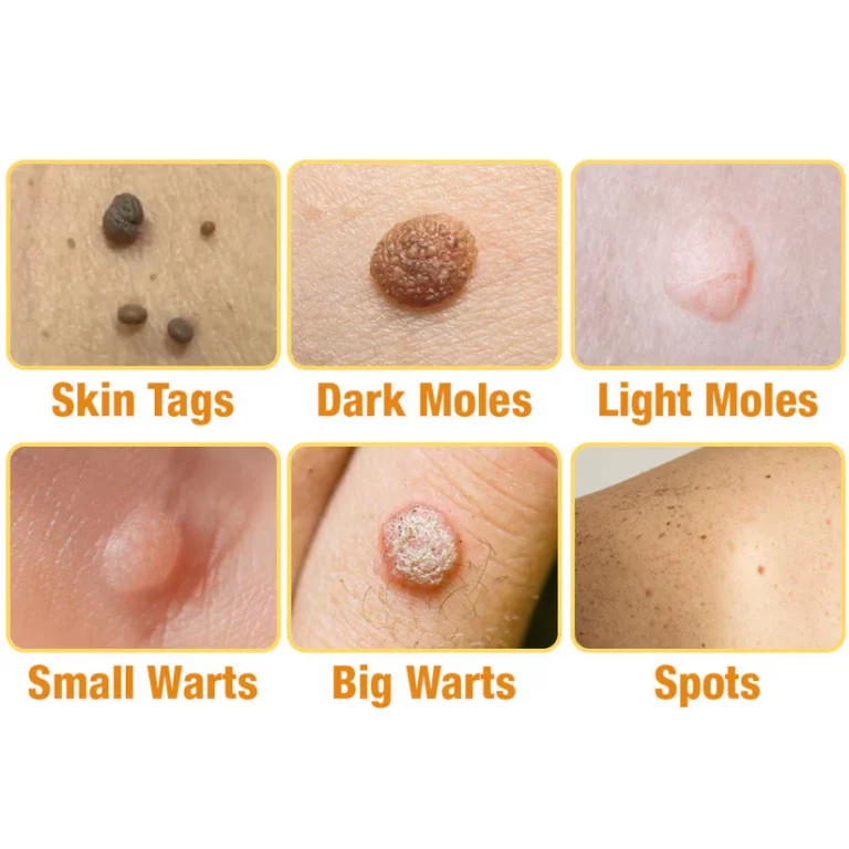 Tag Recede Bee Venom Treatment Spray - Image 2