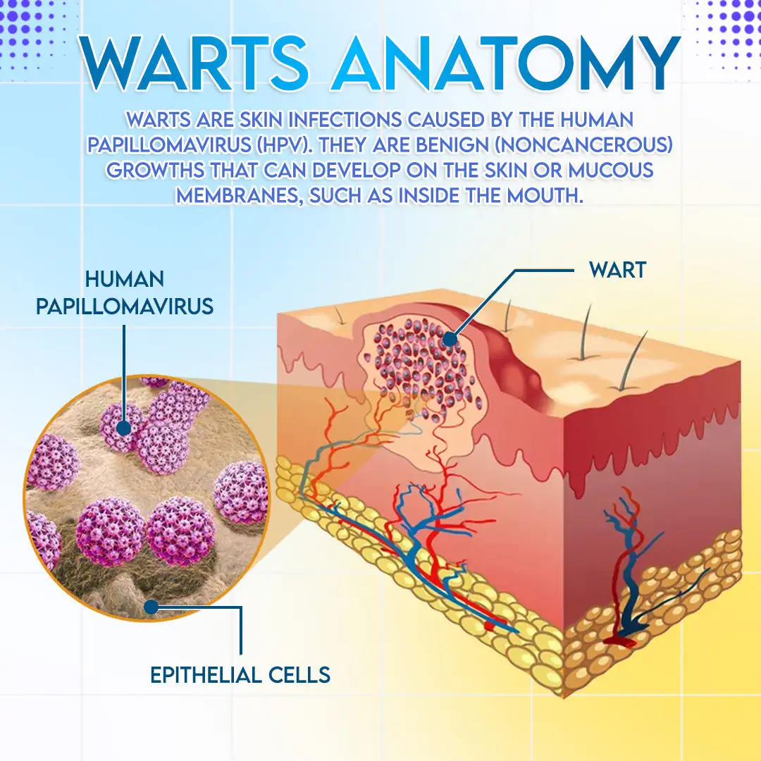 HPV Genital Warts Relief Cream - Image 6