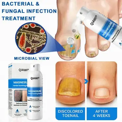 QIAWI Magnesium Herbal Psoriasis Spray - Image 9