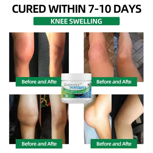 Powerful pain relief& recovery gel - Image 5