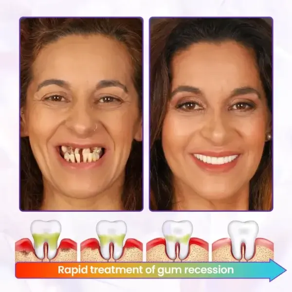 BeeRenew Advanced Gum Regeneration Toothpaste - Image 3