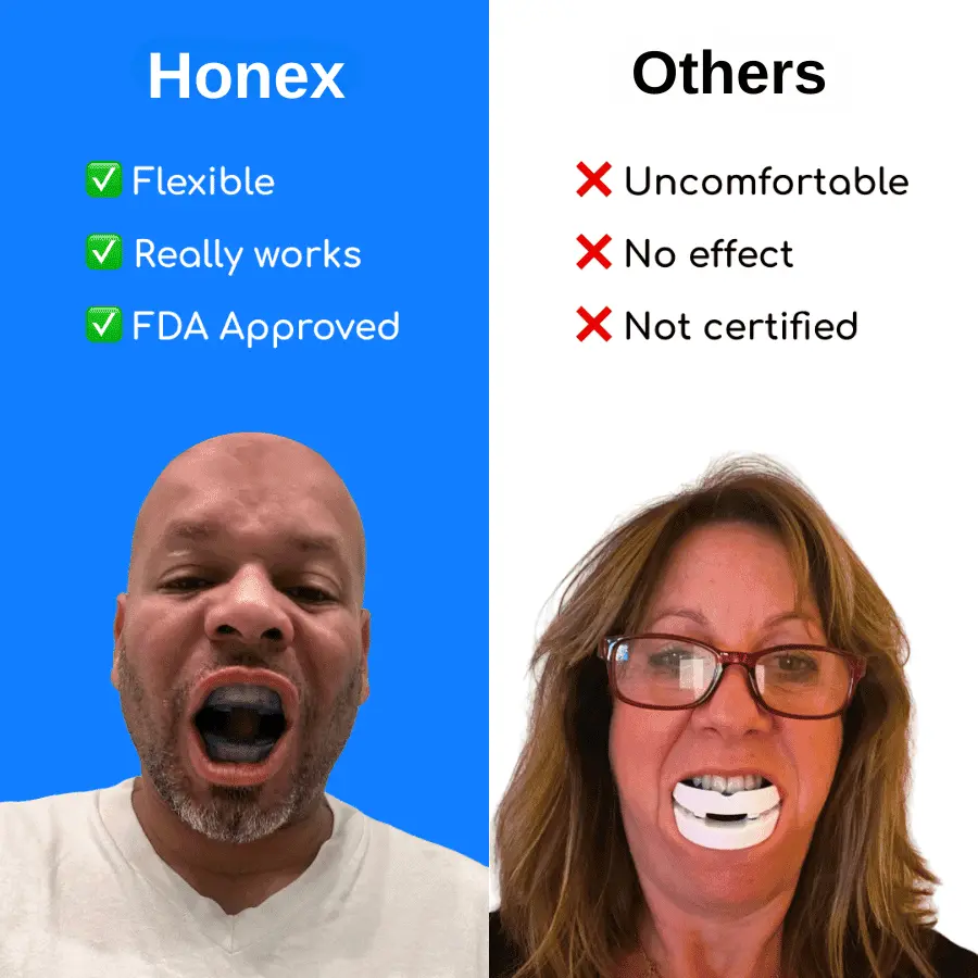 The Quiet Anti-Snoring Mouthpiece Universal Size - Image 2