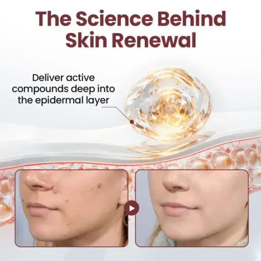 KeraErase Dual-Action Renewal Cream - Image 4
