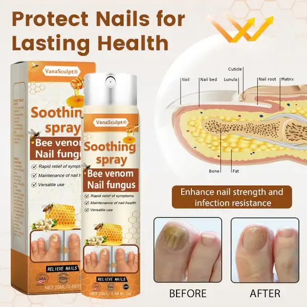 Bee Venom Nail Fungus Spray - Image 5