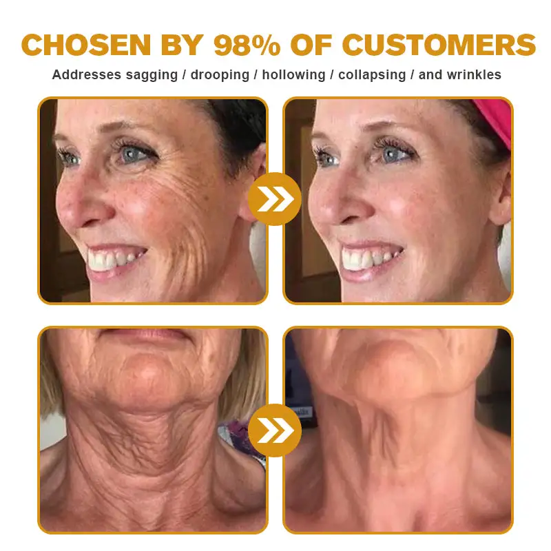 Winter Sale Botox Bee Venom Wrinkle Removal Cream - Image 6
