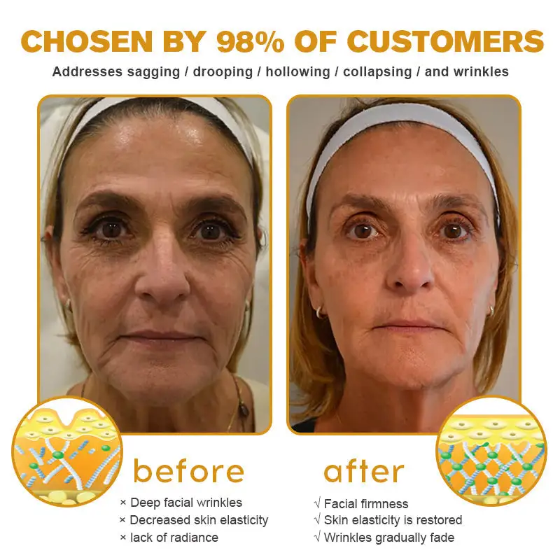 Winter Sale Botox Bee Venom Wrinkle Removal Cream - Image 7
