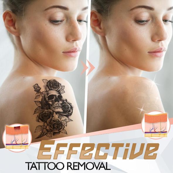 PainFree Tattoo Removal Cream - Image 5