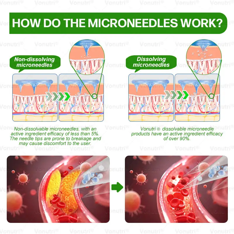 𝑴𝒐𝒓𝒊𝒏𝒈𝗮 · 𝗕𝗲𝗿𝗯𝗲𝗿𝙞𝙣𝙚 × 𝑬𝑮𝑪𝑮 10-in-1 Advanced Nano Microneedle Patch - Image 19