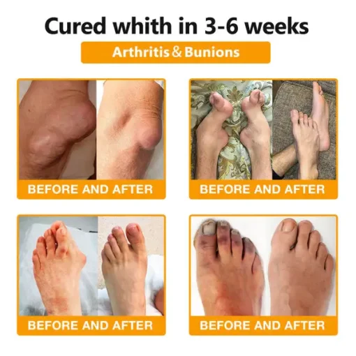 Bee Venom & Turmeric Arthritis Therapy Cream - Image 8