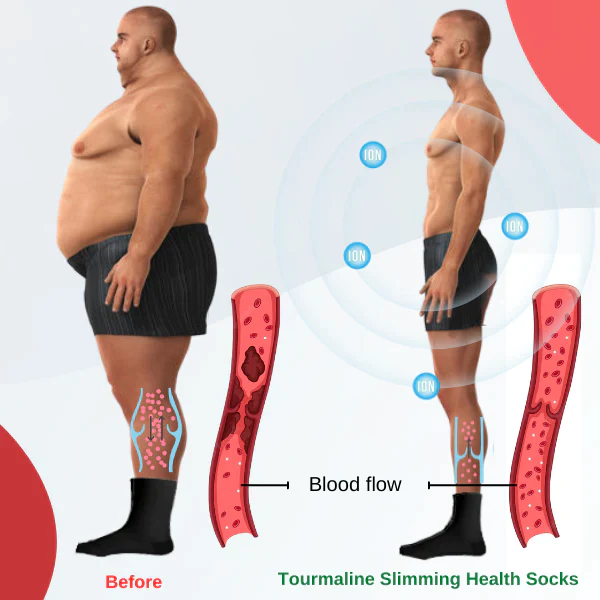 Akupunktur Slimming Socks - Image 4