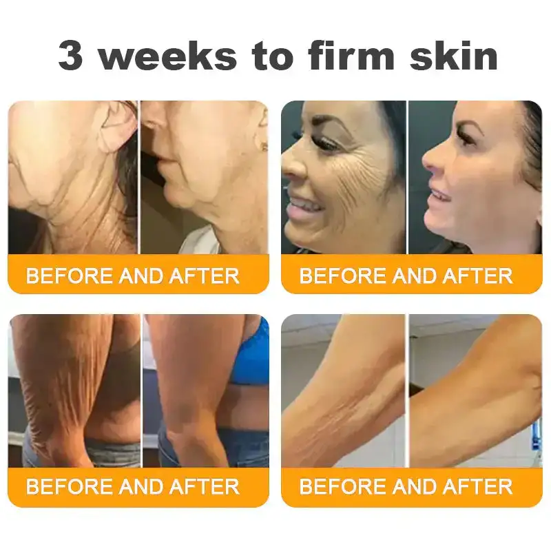 ๐๐๐ ๐๐๐ง๐จ๐ฆ ๐๐ฅ๐ฅ-๐ข๐ง-๐๐ง๐ ๐๐ซ๐๐๐ฆโAnti-Aging, Hydrating & Skin Repair - Image 6