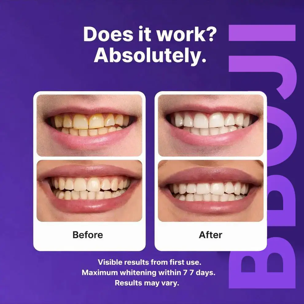Purple Tooth Whitening Strips - Image 4